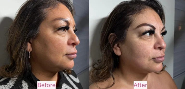 Before and After 1 (1)